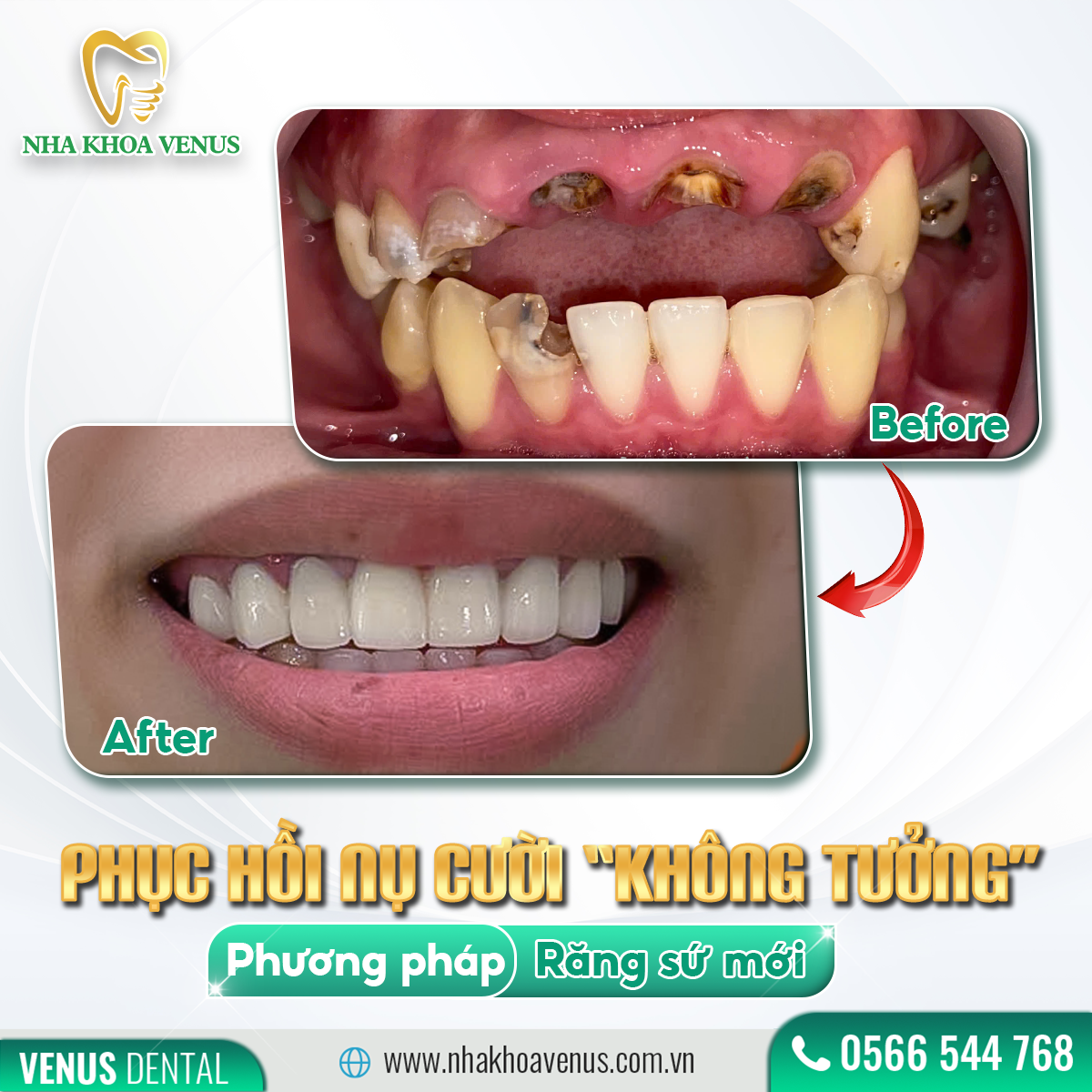 ĂN CƠM MUỘN CÓ NÊN KHÔNG-2938-1