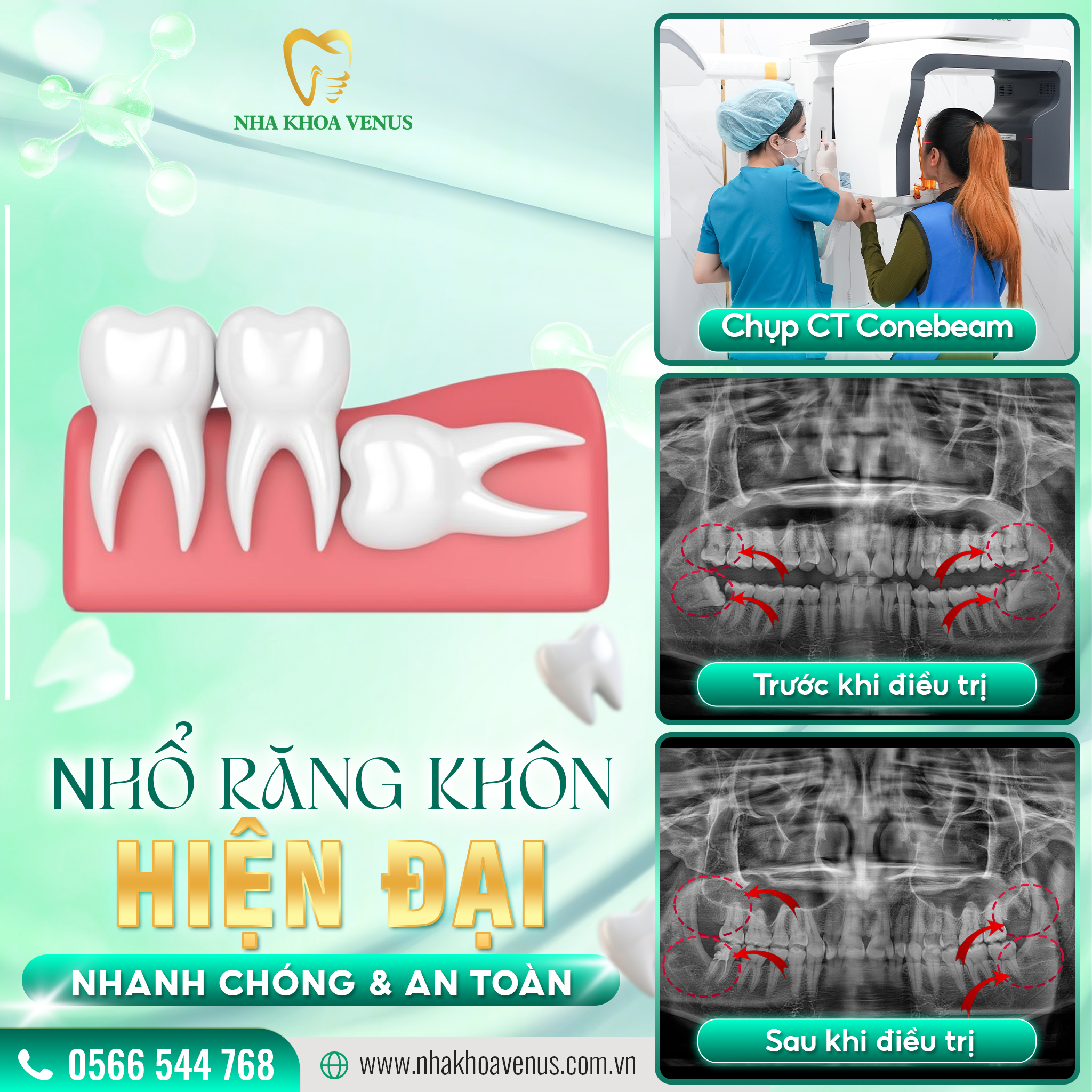 ĂN CƠM MUỘN CÓ NÊN KHÔNG-2938-1