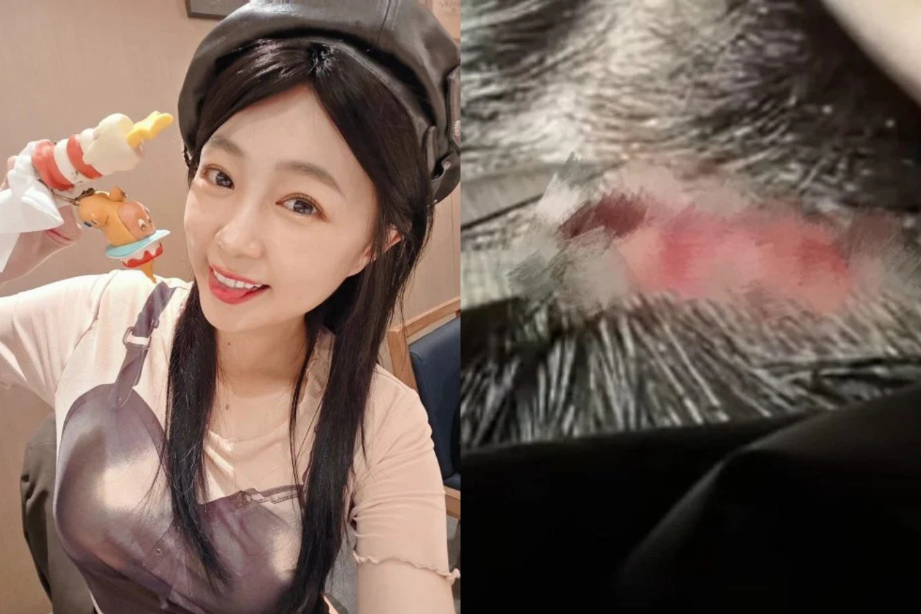 Chiêm Tử Tình gặp tai nạn ngay ngày sinh nhật.-3075-1