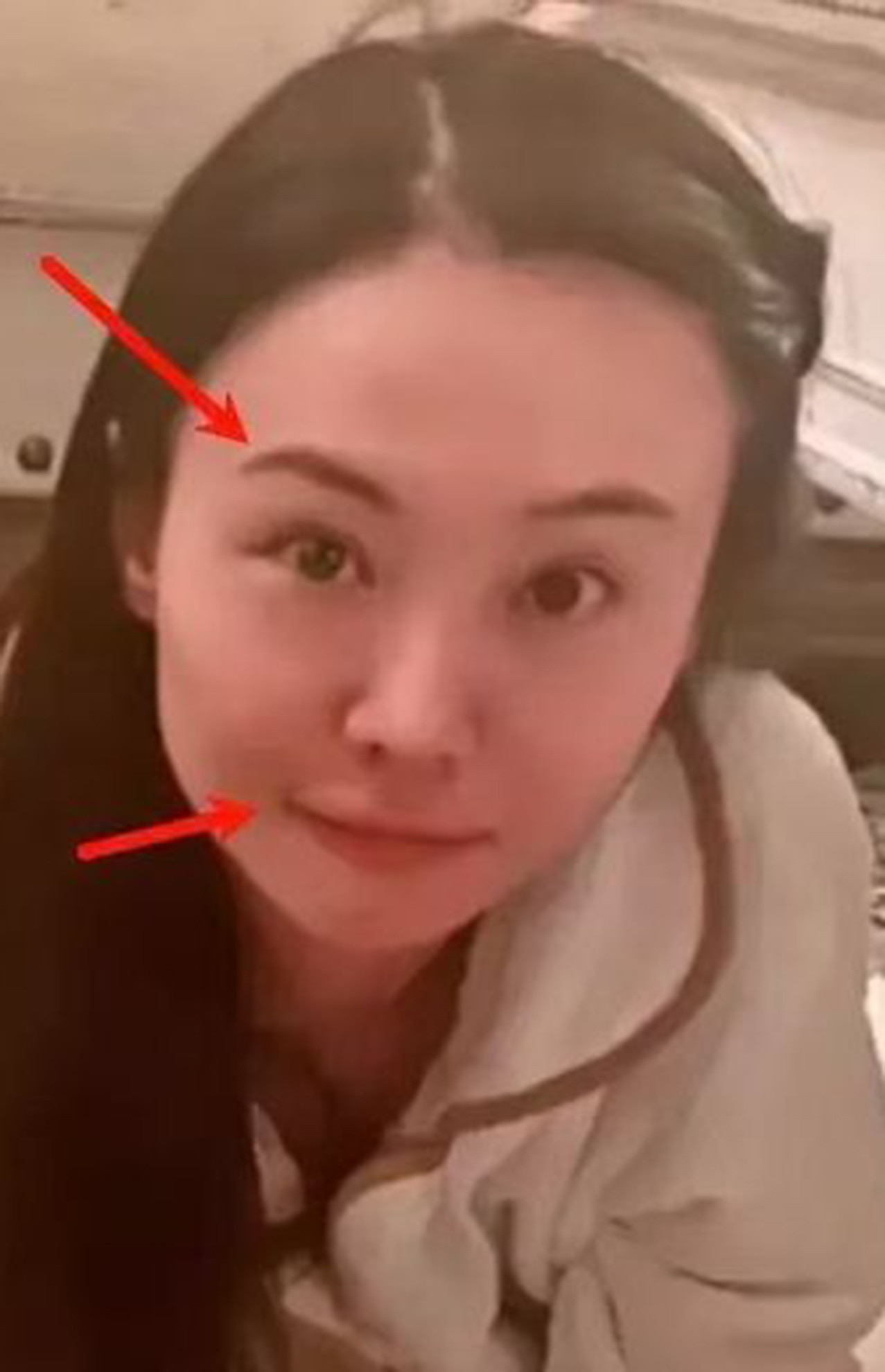 Trịnh Sảng lộ gương mặt khác lạ với phần má căng phồng-2529-1