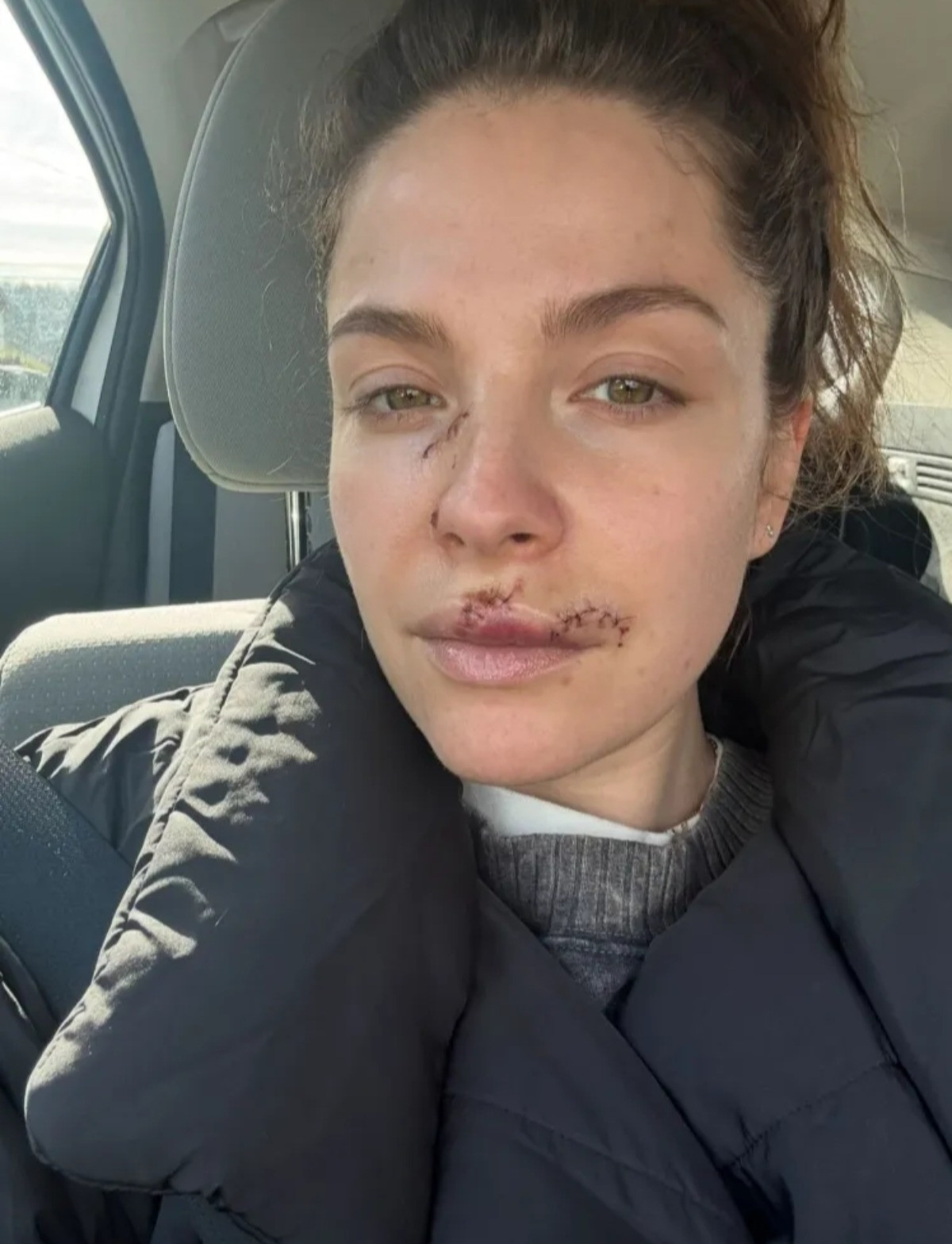 Paige Spara lộ gương mặt đầy vết thương-2865-1