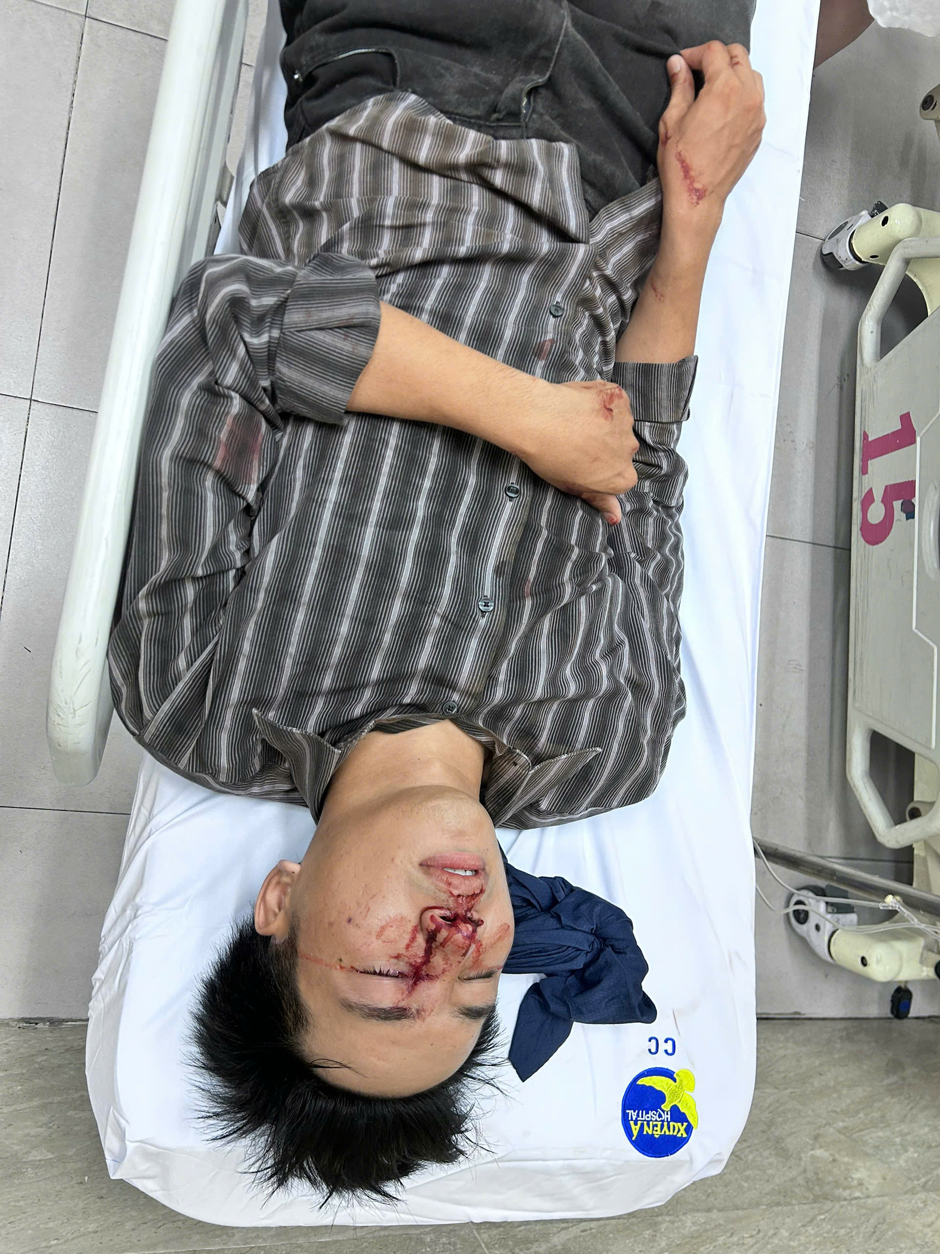 Nam diễn viên Thái Anh bị bạn diễn đánh gãy sống mũi tại phim trường-2136-1