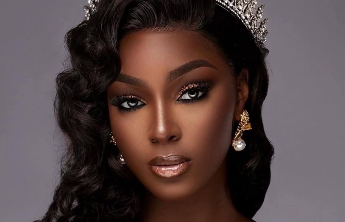 Hoa hậu Cameroon 2025 bị tạm giam