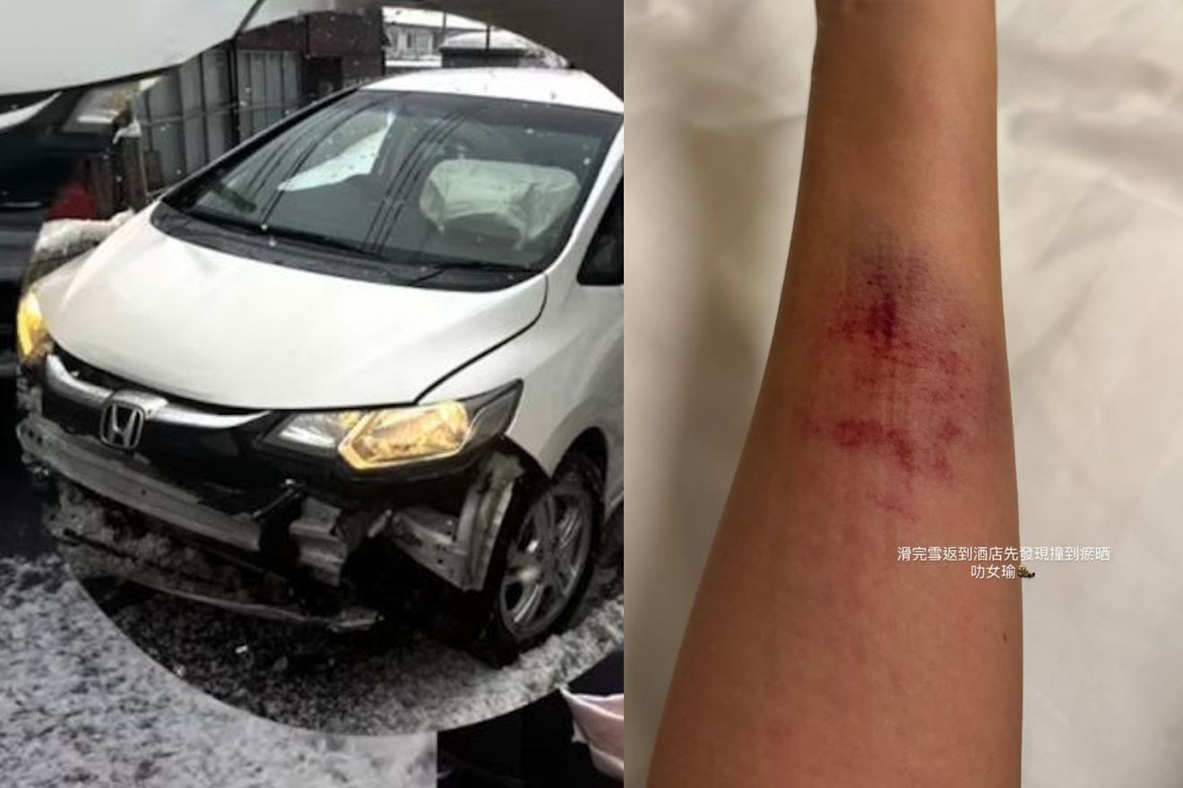 Nữ diễn viên TVB Lương Doãn Du suýt mất mạng