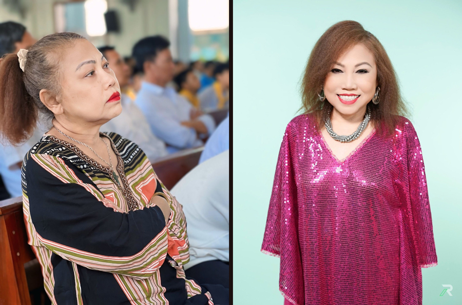 Siu Black nhập viện trong tình trạng sức khỏe yếu