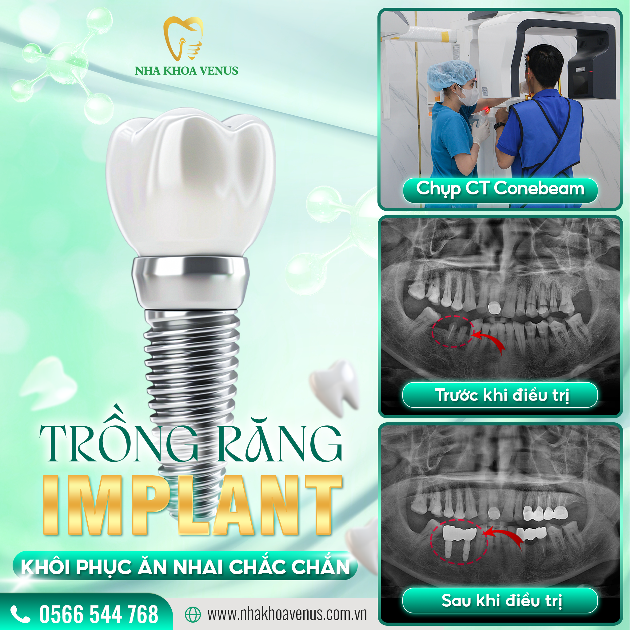 ĂN CƠM MUỘN CÓ NÊN KHÔNG