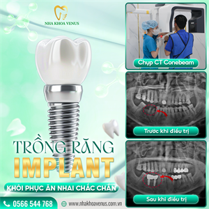 ĂN CƠM MUỘN CÓ NÊN KHÔNG